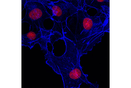 Confocal immunofluorescent analysis of COS-7 cells using β-Actin (13E5) Rabbit mAb (Alexa Fluor ® 647 Conjugate) (blue pseudocolor). Red = Propidium Iodide (PI)/RNase Staining Solution #4087.