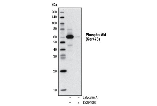 Western blot analysis of extracts of Jurkat cells, treated with either Calyculin A #9902 or LY294002 #9901, using Phospho-Akt (Ser473) (D9E) XP ® Rabbit mAb (Biotinylated) #5012 and detected with Streptavidin-HRP #3999.