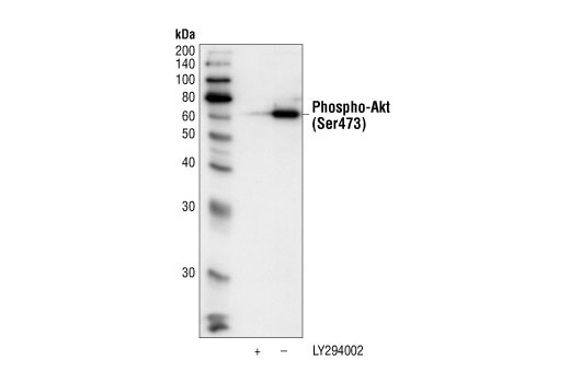 Akt phosphorylated at serine 473 was immunoprecipitated from untreated or LY294002 treated Jurkat cell extracts, using Phospho-Akt (Ser473) (587F11) Mouse mAb (Biotinylated). This immunocomplex was then pulled down using streptavidin beads. Western blotting was performed with Phospho-Akt (Ser473) Antibody #9271.