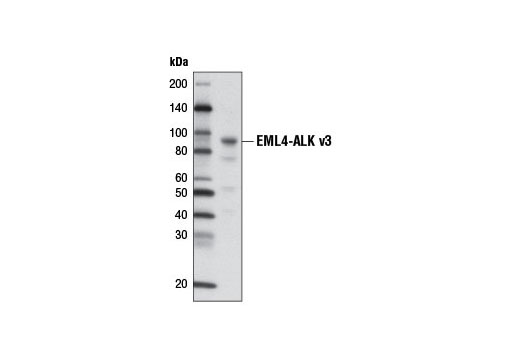 Western blot analysis of extracts from NCI-H2228 cells using ALK (D5F3 ® ) XP ® Rabbit mAb (Biotinylated). Streptavidin-HRP #3999 was used for detection.