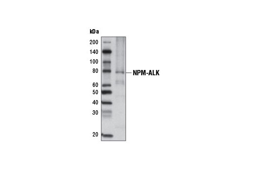 Western blot analysis of extracts from KARPAS-299 cells using ALK (C26G7) Rabbit mAb (Biotinylated). Streptavidin-HRP #3999 was used for detection. Cell Line Source: Dr Abraham Karpas at the University of Cambridge.