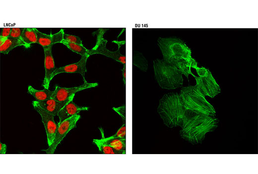 Confocal immunofluorescent analysis of LNCaP (positive, left) and DU 145 (negative, right) cells using Androgen Receptor (D6F11) XP ® Rabbit mAb (Alexa Fluor ® 555 Conjugate) (red). Actin filaments were labeled with Alexa Fluor ® 488 phalloidin (green).