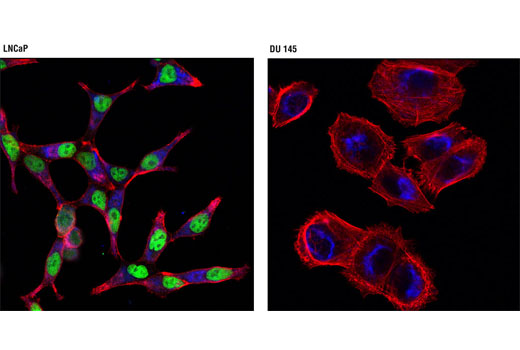 Confocal immunofluorescent analysis of LNCaP (left) and DU 145 (right) cells using Androgen Receptor (D6F11) XP ® Rabbit mAb (Alexa Fluor ® 488 Conjugate) (green) and Hexokinase I (C35C4) Rabbit mAb (Alexa Fluor ® 647 Conjugate) #3540 (blue pseudocolor). Actin filaments were labeled with DY-554 phalloidin (red).