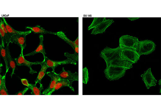 Confocal immunofluorescent analysis of LNCaP (positive, left) and DU 145 (negative, right) cells using Androgen Receptor (D6F11) XP ® Rabbit mAb (Alexa Fluor ® 594 Conjugate) (red). Actin filaments were labeled with Alexa Fluor ® 488 phalloidin (green).