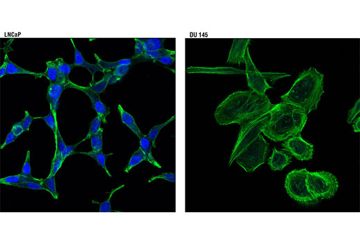 Confocal immunofluorescent analysis of LNCaP (positive, left) and DU 145 (negative, right) cells using Androgen Receptor (D6F11) XP ® Rabbit mAb (Alexa Fluor ® 647 Conjugate) (blue pseudocolor). Actin filaments were labeled with Alexa Fluor ® 488 phalloidin (green).