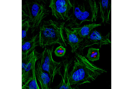 Confocal immunofluorescent analysis of HeLa cells using Phospho-Aurora A (Thr288)/Aurora B (Thr232)/Aurora C (Thr198) (D13A11) XP ® Rabbit mAb (Alexa Fluor ® 555 Conjugate) (red). Actin filaments were labeled with Alexa Fluor ® 488 phalloidin #8878 (green). Blue pseudocolor = DRAQ5 ® #4084 (fluorescent DNA dye).