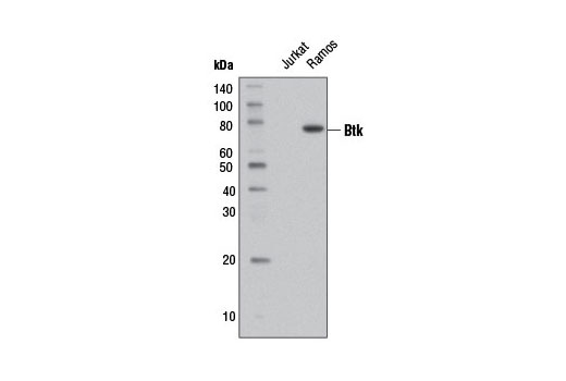 Western blot analysis of Jurkat and Ramos cell extracts using Btk (D3H5) Rabbit mAb (Biotinylated).