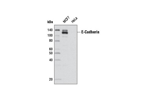 Western blot analysis of extracts from MCF7 and Hela cells using E-Cadherin (24E10) Rabbit mAb (Biotinylated). Streptavidin-HRP #3999 was used for detection.