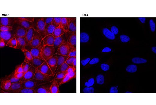 Immunofluorescent analysis of MCF7 (left) and HeLa (right) cells using E-Cadherin (24E10) Rabbit mAb (Alexa Fluor ® 594 Conjugate) (red). Blue pseudocolor = DRAQ5 ® #4084 (fluorescent DNA dye).