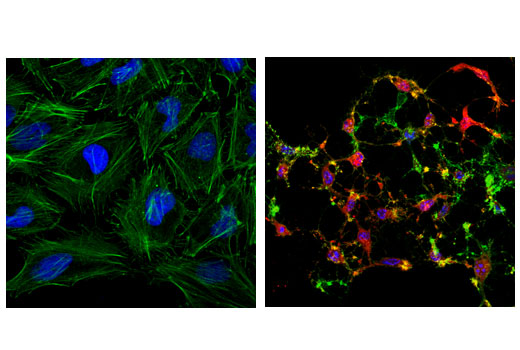 Confocal immunofluorescent analysis of HeLa cells, untreated (left) or treated with Staurosporine #9953 (1 μM, 4 hr; right), using Cleaved Caspase-3 (Asp175) (D3E9) Rabbit mAb (Alexa Fluor ® 555 Conjugate) (red). Actin filaments were labeled with Alexa Fluor ® 488 phalloidin (green). Blue pseudocolor = DRAQ5 ® #4084 (fluorescent DNA dye).