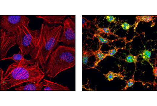 Confocal immunofluorescent analysis of HeLa cells, untreated (left) or staurosporine-treated (right), using Cleaved Caspase-3 (Asp175) Antibody (Alexa Fluor ® 488 Conjugate) (green). Actin filaments have been labeled with Alexa Fluor ® 555 phalloidin #8953 (red). Blue pseudocolor = DRAQ5 ® (fluorescent DNA dye).