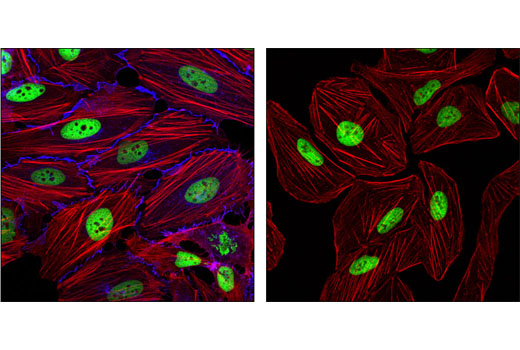 Confocal immunofluorescent analysis of HeLa (left) and NCI-H28 cells (right) using β-Catenin (L54E2) Mouse mAb (Alexa Fluor ® 647 Conjugate) (blue pseudocolor) and Acetyl-Histone H3 (Lys9) (C5B11) Rabbit mAb (Alexa Fluor ® 488 Conjugate) #9683 (green). Actin filaments have been labeled with DY-554 phalloidin (red).