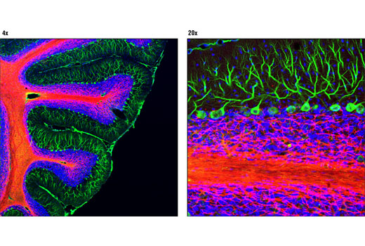 Confocal immunofluorescent analysis of rat cerebellum using CNPase (D83E10) XP ® Rabbit mAb (Alexa Fluor ® 555 Conjugate) (red) and β3-Tubulin (TU-20) Mouse mAb #4466 (green). Blue pseudocolor = DRAQ5 ® #4084 (fluorescent DNA dye).