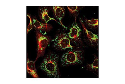Confocal immunofluorescent analysis of SKOV3 cells using COX IV (3E11) Rabbit mAb (Alexa Fluor ® 488 Conjugate) (green) and β-Tubulin (9F3) Rabbit mAb (Alexa Fluor ® 555 Conjugate) #2116 (red).