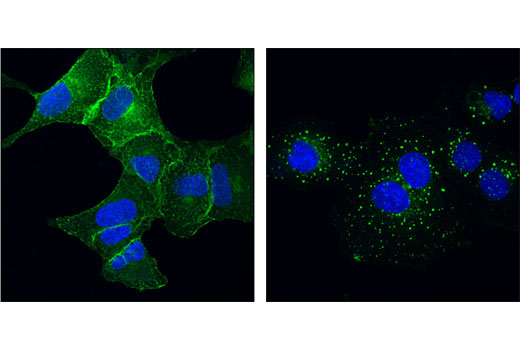 Confocal immunofluorescent analysis of A549 cells, serum-starved (left) or EGF-treated #8916 (right), using EGF Receptor (D38B1) XP ® Rabbit mAb (Alexa Fluor ® 488 Conjugate) (green). Blue psuedocolor= DRAQ5 ® #4084 (fluorescent nuclear dye).