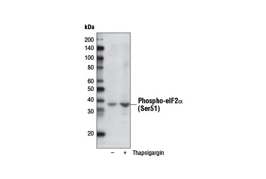 Western blot analysis of extracts from NIH/3T3 cells, untreated or thapsigargin-treated, using Phospho-eIF2α (Ser51) (D9G8) XP ® Rabbit mAb (Biotinylated).
