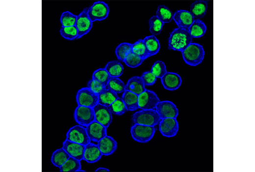 Confocal immunofluorescent analysis of HT-29 cells using EpCAM (VU1D9) Mouse mAb (Alexa Fluor® 647 Conjugate) (blue pseudocolor) and Di-Methyl-Histone H3 (Lys4) (C64G9) Rabbit mAb #9725 (green).