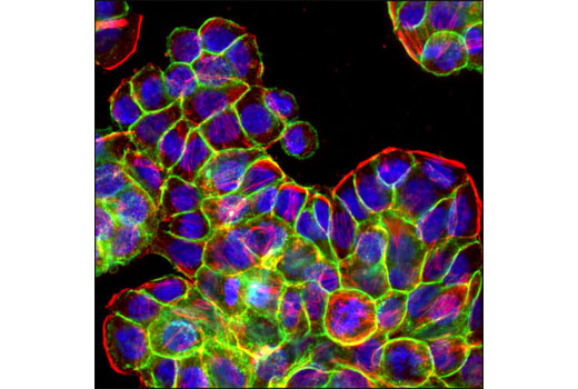 Confocal immunofluorescent analysis of HT-29 cells using EpCAM (VU1D9) Mouse mAb (Alexa Fluor® 488 Conjugate) (green). Actin filaments were labeled with DY-554 phalloidin (red). Blue pseudocolor = DRAQ5® #4084 (fluorescent DNA dye).