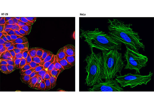 Confocal immunofluorescent analysis of HT-29 (left) and HeLa (right) cells using EpCAM (VU1D9) Mouse mAb (Alexa Fluor ® 594 Conjugate) (red). Actin filaments were labeled with Alexa Fluor ® 488 phalloidin (green). Blue pseudocolor = DRAQ5 ® #4084 (fluorescent DNA dye).