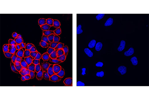 Confocal immunofluorescent analysis of HT-29 cells (left) and HeLa cells (right) using EpCAM (VU1D9) Mouse mAb (Alexa Fluor ® 555 Conjugate) (red). Blue pseudocolor= DRAQ5 ® #4084 (fluorescent DNA dye).