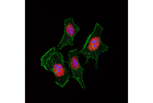 Confocal immunofluorescent analysis of HeLa cells using Fibrillarin (C13C3) Rabbit mAb (Alexa ® 647 Conjugate) (blue pseudocolor). Actin filaments were labeled with DyLight™ 488 Phalloidin #12935 (green). Red pseudocolor = Propidium Iodide (PI)/RNase Staining Solution #4087 (fluorescent DNA dye).