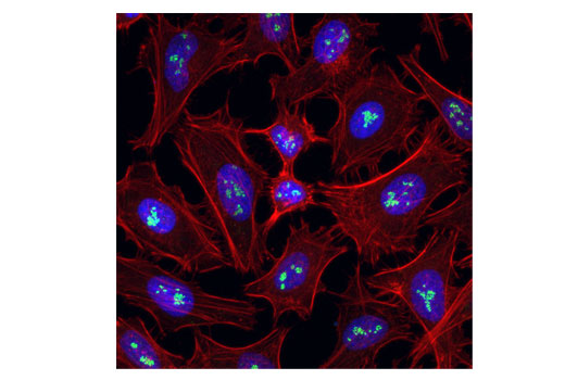 Confocal immunofluorescent analysis of HeLa cells using Fibrillarin (C13C3) Rabbit mAb (Alexa Fluor ® 488 Conjugate) (green). Actin filaments were labeled with DyLight™ 554 Phalloidin #13054 (red). Blue pseudocolor = DRAQ5 ® #4084 (fluorescent DNA dye).