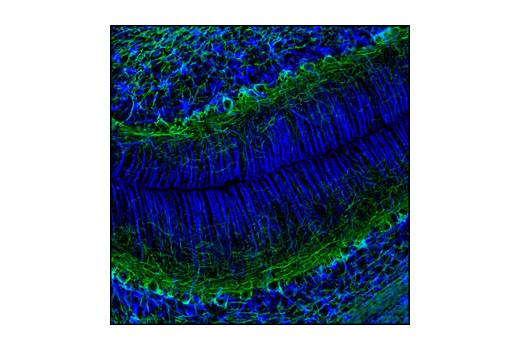 Confocal immunofluorescent analysis of rat brain using GFAP (GA5) Mouse mAb (Alexa Fluor ® 647 Conjugate) (blue pseudocolor) and Neurofilament-L (DA2) Mouse mAb #2835 (green).