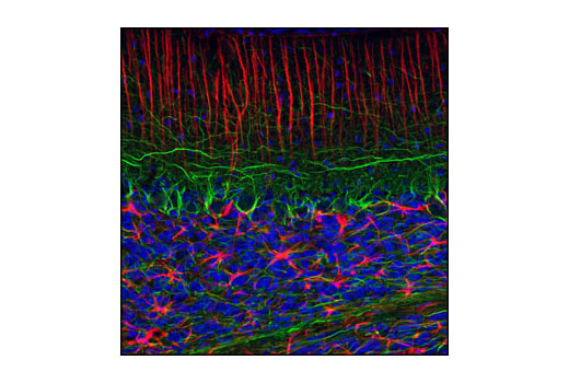 Confocal immunofluorescent analysis of normal rat cerebellum using GFAP (GA5) Mouse mAb (Alexa Fluor ® 555 Conjugate) (red) and Neurofilament-L (C28E10) Rabbit mAb #2837 (green). Blue pseudocolor = DRAQ5 ® #4084 (fluorescent DNA dye).