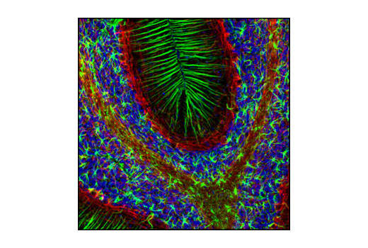Confocal immunofluorescent analysis of rat brain using GFAP (GA5) Mouse mAb (Alexa Fluor ® 488 Conjugate) (green) and Neurofilament-L (DA2) Mouse mAb #2835 (red). Blue pseudocolor = DRAQ5 ® #4084 (fluorescent DNA dye).