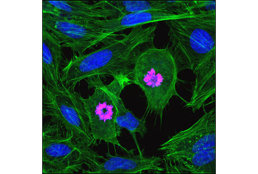 Confocal immunofluorescent analysis of HeLa cells using Phospho-Histone H3 (Ser10) (D2C8) XP ® Rabbit mAb (Alexa Fluor ® 594 Conjugate) (red). Actin filaments were labeled with Alexa Fluor ® 488 phalloidin (green). Blue pseudocolor = DRAQ5 ® #4084 (fluorescent DNA dye).