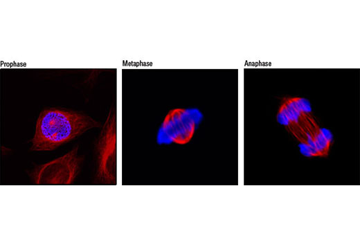 Confocal immunofluorescent analysis of mitotic HeLa cells using Phospho-Histone H3 (Ser10) Antibody (Alexa Fluor® 647 Conjugate) (blue pseudocolor) and β-Tubulin (9F3) Rabbit mAb (Alexa Fluor® 555 Conjugate) (red).