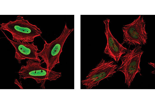 Confocal immunofluorescent analysis of HeLa cells, treated with TSA #9950 (left) and untreated (right), using Acetyl-Histone H3 (Lys9) (C5B11) Rabbit mAb (Alexa Fluor ® 488 Conjugate) (green). Actin filaments have been labeled with DY-554 phalloidin (red).