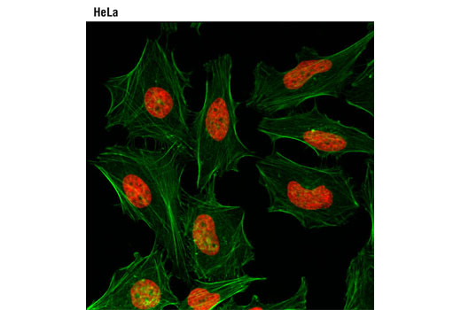 Confocal immunofluorescent analysis of HeLa cells using Di-Methyl-Histone H3 (Lys27) (D18C8) XP ® Rabbit mAb (Alexa Fluor ® 647 Conjugate) (red). Actin filaments were labeled with Alexa Fluor ® 488 Phalloidin #8878 (green).