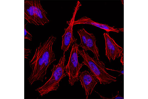 Confocal immunofluorescent analysis of HeLa cells using Histone H3 (D1H2) XP ® Rabbit mAb (Alexa Fluor ® 647 Conjugate) (blue pseudocolor). Actin filaments were labeled with DY-554 phalloidin (red).