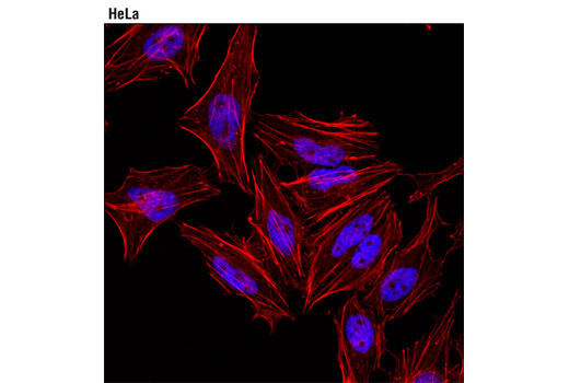 Confocal immunofluorescent analysis of HeLa cells using Tri-Methyl-Histone H3 (Lys27) (C36B11) Rabbit mAb (Alexa Fluor ® 647 Conjugate) (blue pseudocolor). Actin filaments were labeled with DY-554 phalloidin (red).