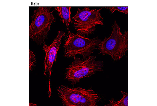 Confocal immunofluorescent analysis of HeLa cells using Tri-Methyl-Histone H3 (Lys4) (C42D8) Rabbit mAb (Alexa Fluor ® 647 Conjugate) (pseudocolor blue). Actin filaments were labeled with DY 554 phalloidin (red).