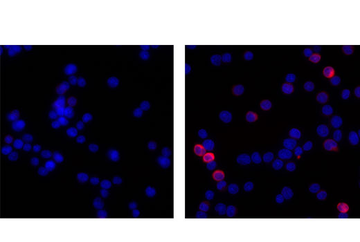 Immunofluorescent analysis of Ramos cells untreated (left) or treated with IgM (12 μg/mL, 10 min, right) using Phospho-HS1 (Tyr397) (D12C1) XP ® Rabbit mAb (Alexa Fluor ® 647 Conjugate) (red). Blue pseudocolor= ProLong ® Gold Antifade Reagent with DAPI #8961.