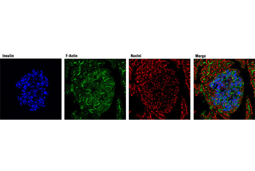 Confocal immunofluorescent analysis of rat pancreas using Insulin (C27C9) Rabbit mAb (Alexa Fluor ® 647 Conjugate) (blue pseudocolor). Actin filaments are labeled with Alexa Fluor ® 488 phalloidin (green). Red = Propidium Iodide (PI)/RNase Staining Solution #4087.