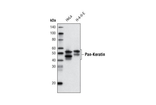 Western blot analysis of extracts from HeLa and H-4-II-E cells using Pan-Keratin (C11) Mouse mAb (Biotinylated) detected using Streptavidin-HRP #3999.