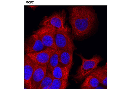 Confocal immunofluorescent analysis of MCF7 cells using Pan-Keratin (C11) Mouse mAb (Alexa Fluor ® 555 Conjugate) (red). Blue pseudocolor = DRAQ5 ® #4084 (fluoresent DNA dye).