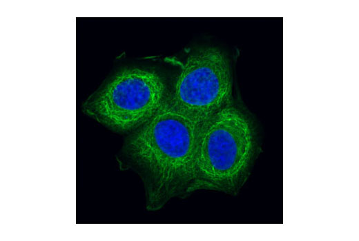 Confocal immunofluorescent analysis of MCF-7 cells using Pan-Keratin (C11) Mouse mAb (Alexa Fluor ® 488 Conjugate) (green). Blue pseudocolor = DRAQ5 ® #4084 (fluorescent DNA dye).