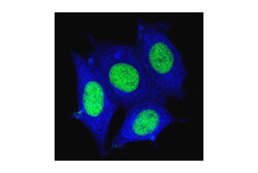Confocal immunofluorescent analysis of MCF-7 cells using Pan-Keratin (C11) Mouse mAb (Alexa Fluor ® 647 Conjugate) (blue pseudocolor) and Histone H3 Antibody #9715 (green).