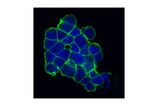 Confocal immunofluorescent analysis of H526 cells using c-Kit (Ab81) Mouse mAb (Alexa Fluor ® 488 Conjugate) (green). Blue pseudocolor = DRAQ5 ® #4084 (fluorescent DNA dye).