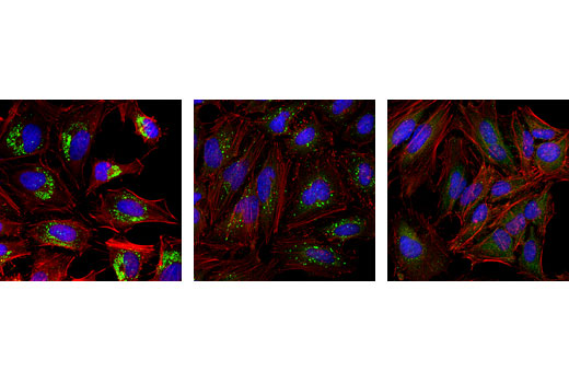 Confocal immunofluorescent analysis of HeLa cells, chloroquine-treated (50 μM, overnight; left), nutrient-starved with EBSS (4 hr, middle), or untreated (right) using LC3A/B (D3U4C) XP ® Rabbit mAb (Alexa Fluor ® 488 Conjugate) #13082 (green) and β-Actin (8H10D10) Mouse mAb #3700 (red). Blue pseudocolor = DRAQ5 ® #4084 (fluorescent DNA dye).