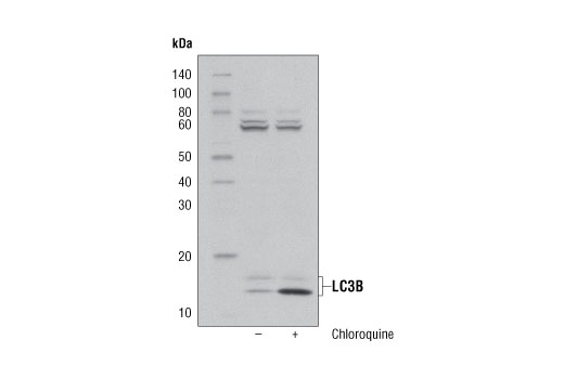 Western blot analysis of HeLa cell extracts, untreated (-) or chloroquine-treated (50 μM; +), using LC3B (D11) XP ® Rabbit mAb (Biotinylated).