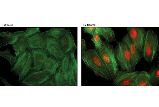 Immunofluorescent analysis of HeLa cells, untreated (left) or UV-treated (right) using Phospho-p38 MAPK (Thr180/Tyr182) (D3F9) XP ® Rabbit mAb (Alexa Fluor ® 594 Conjugate) (red). Actin filaments were labeled with Alexa Fluor ® 488 phalloidin (green).