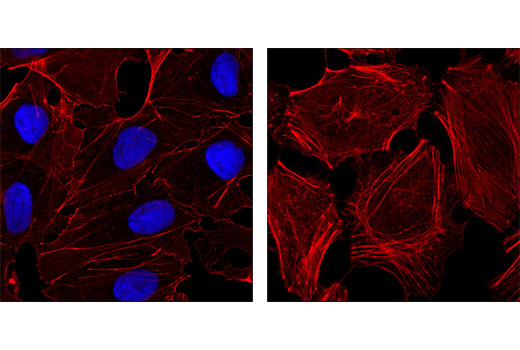 Confocal immunofluorescent analysis of NTERA-2 cells (left) and HeLa cells (right) using Nanog (D73G4) XP ® Rabbit mAb (Alexa Fluor ® 647 Conjugate) (blue pseudocolor). Actin filaments were labeled with DY-554 phalloidin (red).