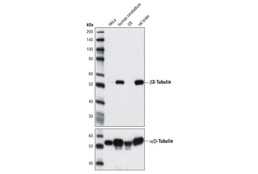 Western blot analysis of extracts from various cell lines and tissues using β3-Tubulin (D65A4) XP ® Rabbit mAb (upper) and α/β-Tubulin Antibody #2148 (lower).