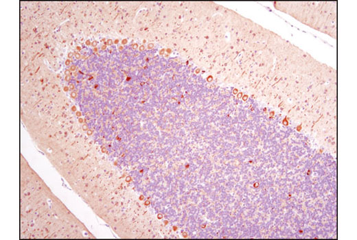 Immunohistochemical analysis of paraffin-embedded rat cerebellum using β3-Tubulin (D65A4) XP ® Rabbit mAb.