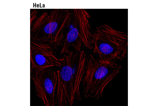 Confocal immunofluorescent analysis of HeLa cells using NUP98 (C39A3) Rabbit mAb (Alex Fluor ® 647 Conjugate) (blue pseudocolor). Actin filaments were labeled with DyLight™ 554 Phalloidin #13054 (red).